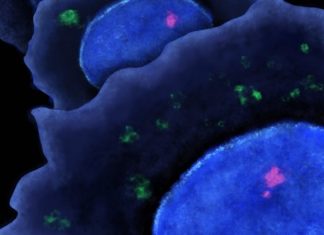 How cancer metastasis happens: Researchers reveal a key mechanism