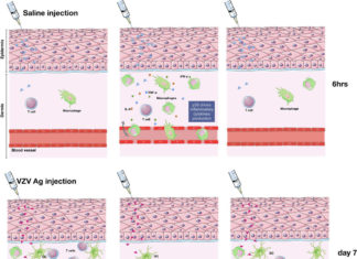 Improving vaccines for the elderly by blocking inflammation