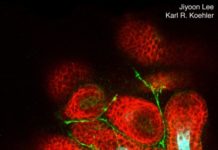 In scientific first, IU researchers grow hairy skin in a dish