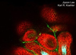 In scientific first, IU researchers grow hairy skin in a dish