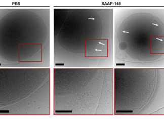 Optimized human peptide found to be an effective antibacterial agent