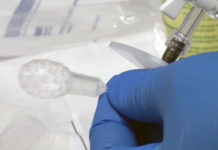 Researchers develop swallowable test to detect pre-cancerous Barrett’s esophagus