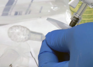 Researchers develop swallowable test to detect pre-cancerous Barrett’s esophagus