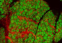 Scarring molecule in fat tissue links obesity with distressed fat