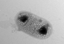 Scientists design bacteria to reflect ‘sonar’ signals for ultrasound imaging