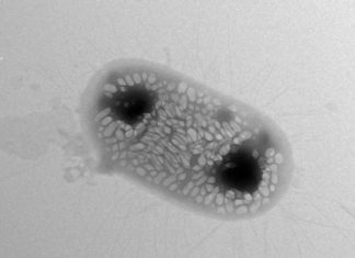 Scientists design bacteria to reflect ‘sonar’ signals for ultrasound imaging
