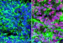 Scientists make cells that enable the sense of touch