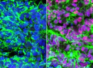 Scientists make cells that enable the sense of touch