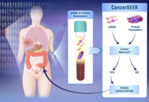 Single blood test screens for eight cancer types