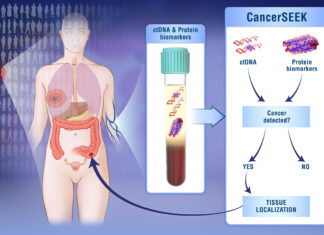 Single blood test screens for eight cancer types