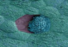 Women with polycystic ovary syndrome have less bacterial diversity in gut