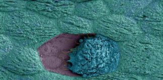 Women with polycystic ovary syndrome have less bacterial diversity in gut