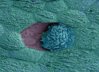 Women with polycystic ovary syndrome have less bacterial diversity in gut