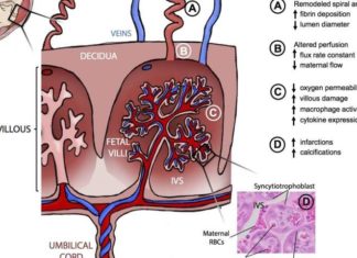 Zika virus damages placenta, which may explain malformed babies