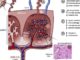 Zika virus damages placenta, which may explain malformed babies
