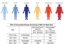 Severe obesity linked to newly identified gene mutations