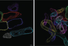Study finds excess fat disrupts heart cell’s energy system