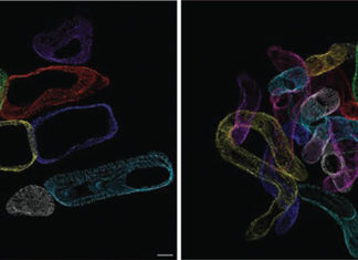 Study finds excess fat disrupts heart cell’s energy system