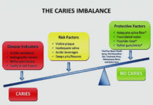 Cavity prevention approach effectively reduces tooth decay