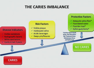 Cavity prevention approach effectively reduces tooth decay