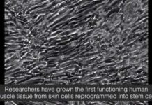 Biomedical engineers have grown the first functioning human skeletal muscle from induced pluripotent stem cells.