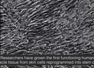 Biomedical engineers have grown the first functioning human skeletal muscle from induced pluripotent stem cells.