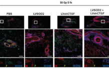 Viral gene therapy could improve results from breast reconstruction after cancer treatment