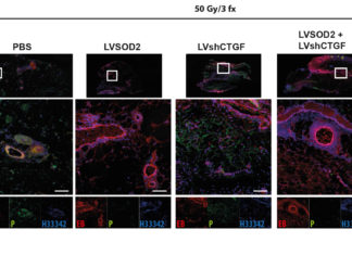 Viral gene therapy could improve results from breast reconstruction after cancer treatment