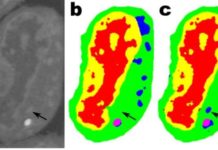 A newly developed convolutional neural network learns more quickly and requires less image data sets than conventional networks