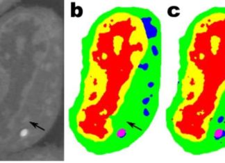 A newly developed convolutional neural network learns more quickly and requires less image data sets than conventional networks
