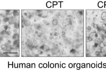 A possible way to protect intestinal walls from damage due to chemotherapy