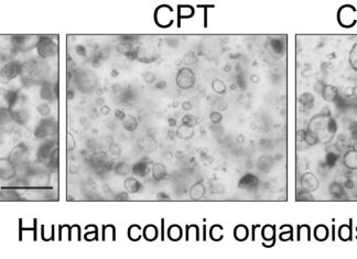A possible way to protect intestinal walls from damage due to chemotherapy