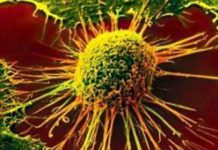 Adding crizotinib to radiation therapy may help preserve hearing in patients with NF2