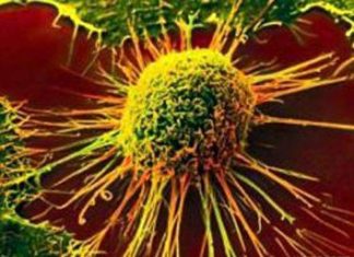 Adding crizotinib to radiation therapy may help preserve hearing in patients with NF2