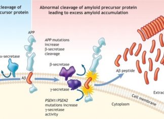 Amyloid Protein Transmission Through Neurosurgery