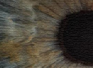 Artificial intelligence quickly and accurately diagnoses eye diseases and pneumonia