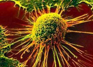 Cancer metastasis: Cell polarity matters