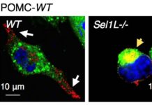 Clues to Obesity’s Roots Found in Brain’s Quality Control Process