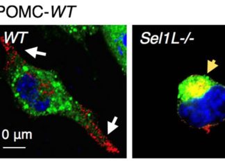 Clues to Obesity’s Roots Found in Brain’s Quality Control Process