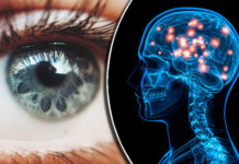 Simple Walking Test May Help Diagnose Dementia
