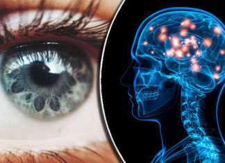 Simple Walking Test May Help Diagnose Dementia