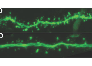 Dim light may make us dumber