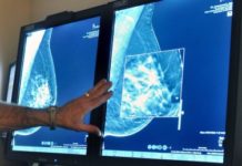 Doctors warn of heart risk from some breast cancer therapies