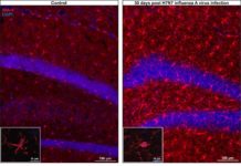 Flu may impact brain health