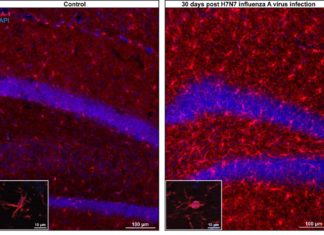Flu may impact brain health
