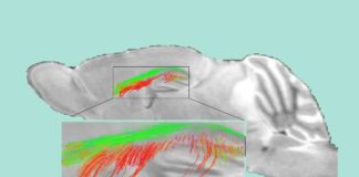 Half of all dementias start with damaged ‘gatekeeper cells’