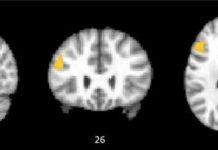 Brain Imaging Helps Redefine Intelligence