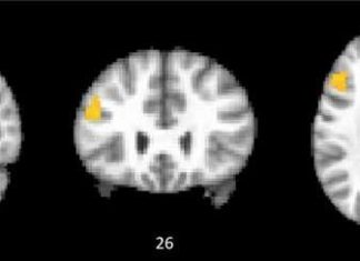 Brain Imaging Helps Redefine Intelligence