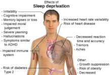 How Insomnia Kills