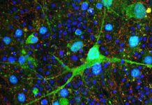 LAB GROWN HUMAN CEREBELLAR CELLS YIELD CLUES TO AUTISM